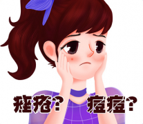 痘痘与痤疮是一样的吗?