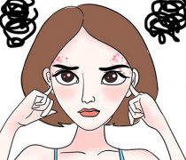 缓解痘痘恶化的方法有哪些？