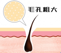 引起毛孔粗大的原因有哪些?