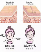 皮肤补不进水怎么回事？