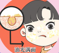 油性肌肤有什么好处,如何保养油性肌肤?