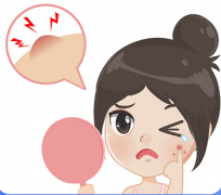 肌肤为什么会长痘痘？