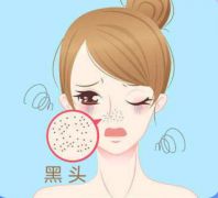 黑头是如何形成的？