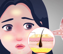 如何有效减轻皮肤油腻感?