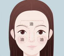 为什么T区爱出油？