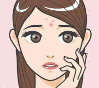 如何有效处理经期前长痘?