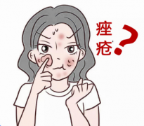 什么是痤疮，痘痘跟痤疮一样吗，它们是怎么形