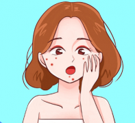 你真的了解痘痘吗？